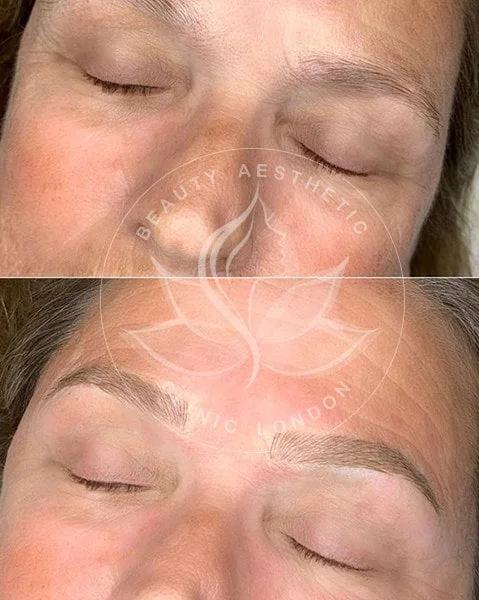 Detailed view of microblading eyebrows, highlighting the natural-looking, perfectly shaped brow strokes created with precision