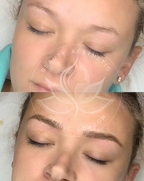 Detailed view of microblading eyebrows, highlighting the natural-looking, perfectly shaped brow strokes created with precision