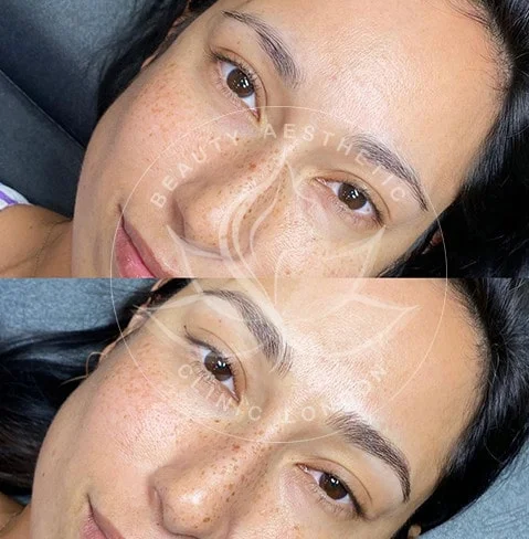 Detailed view of microblading eyebrows, highlighting the natural-looking, perfectly shaped brow strokes created with precision