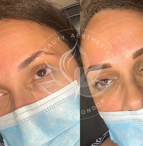 Detailed view of microblading eyebrows, highlighting the natural-looking, perfectly shaped brow strokes created with precision