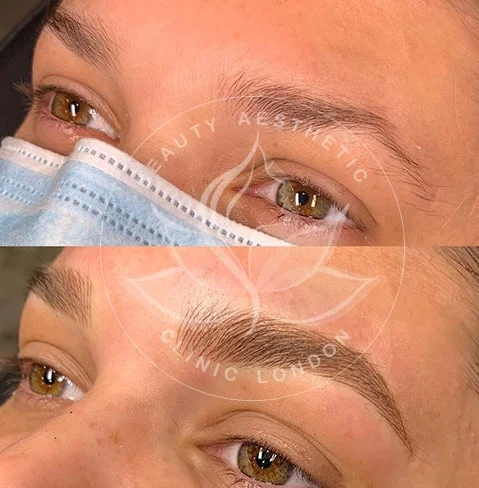 Detailed view of microblading eyebrows, highlighting the natural-looking, perfectly shaped brow strokes created with precision