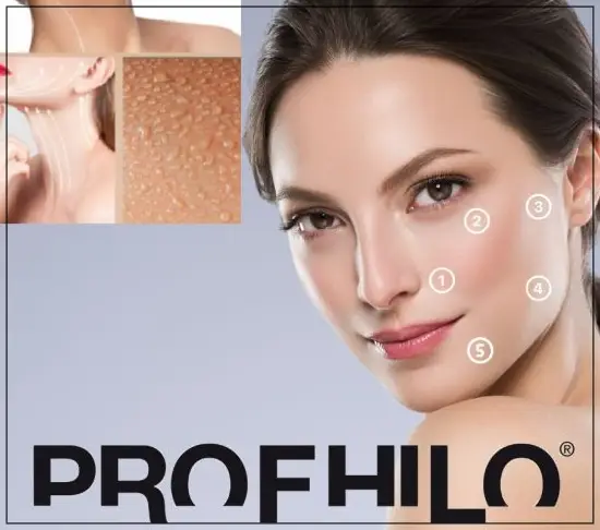 profhilo-treatment-london